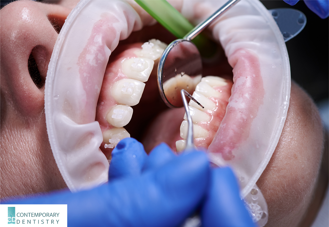 dental check