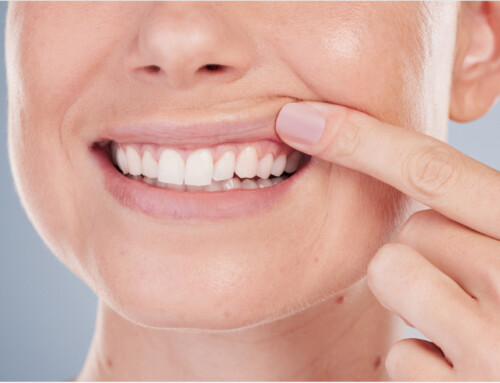 Can You Get a Cavity Under a Crown? What You Need to Know