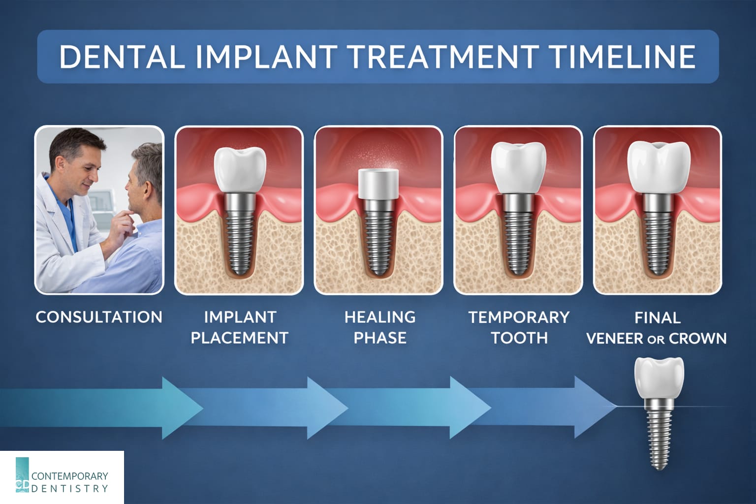 dental-implant-treatment-timeline-infographic Infographic showing the dental implant treatment timeline including consultation, implant placement, healing phase, temporary tooth, and final crown placement.