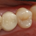 teeth close up