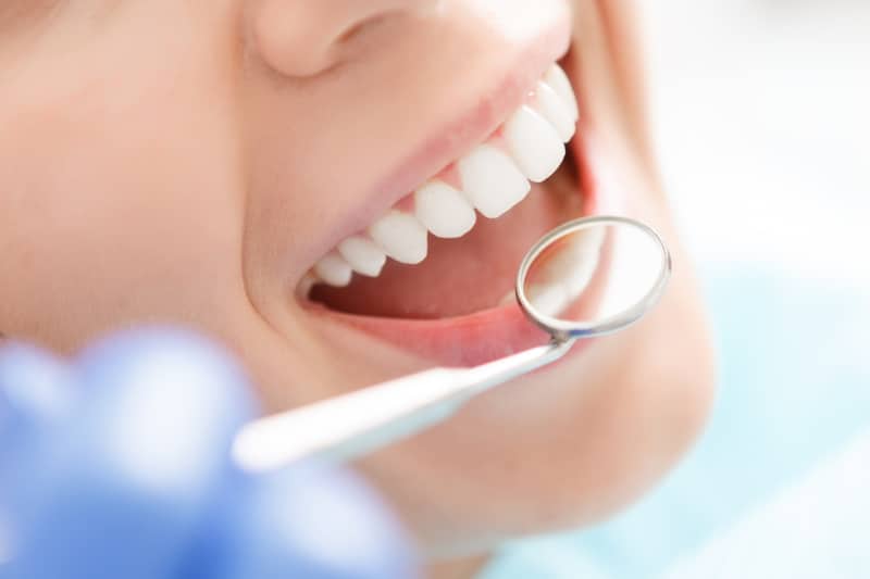 woman having her teeth inspected